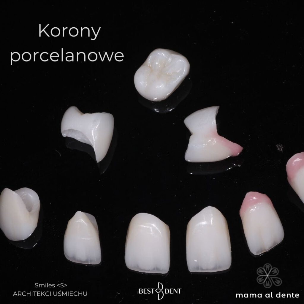 Korony porcelanowe