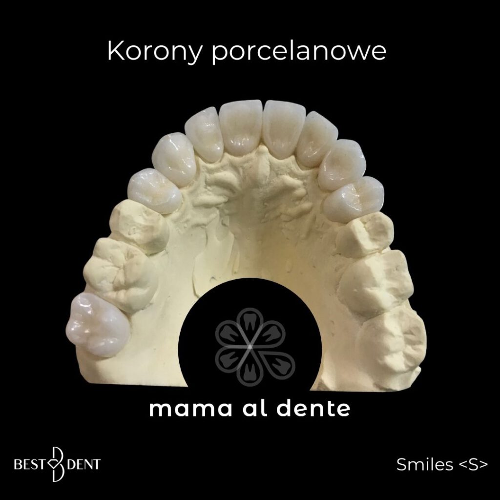 Korony porcelanowe