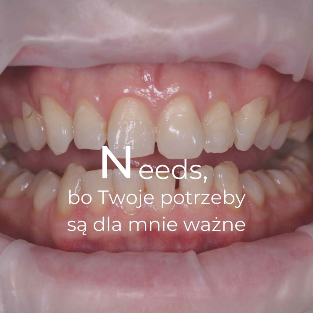 Uzębienie pacjenta